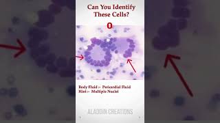 Can you identify these Cells In Body Fluid ? 🧐🙄🤔 #Quiz 393