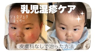 乳児湿疹ができた時のケア方法！保湿の方法、使っているプチプラ保湿剤