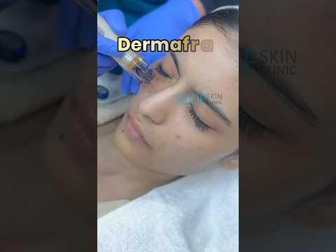 Skin treatment |pigmentation treatment | Facial for skin glow | glowing skin facial