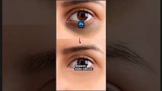 Remove Dark Eye Circles Effortlessly 👁️✨ | Easy Photoshop Tutorial #graphictips #photoshoptutorial