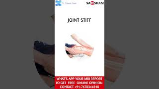 Stiff Knee Due to Arthritis @DrdebashishChanda   #orthopedics#stiffknee