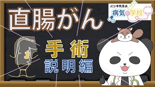 【直腸がんで手術と言われたら（手術説明編）】