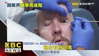 全球首例！ 美醫療團隊完成「人類全眼移植手術」