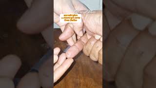 হাতে বা পায়ে কাটা ফুটলে ৫ সেকেন্ডে তুলে ফেলার নিন্জা টেকনিক, #tricks #trend #truck #tips