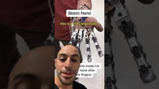 BIONIC HAND! #shorts