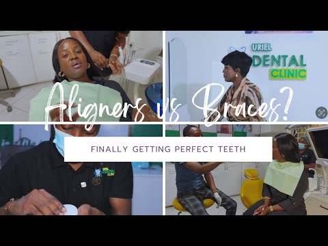 A DREAM COME TRUE - MY JOURNEY TO GETTING THE PERFECT TEETH | WITH URIEL DENTAL