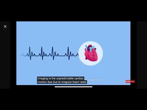 CT5300 industry first digital detector AI CT #digital #ai #ctscan #ct #hospital #innovation #philips