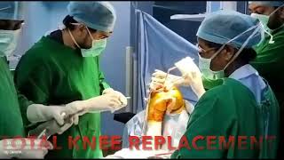 Total knee replacement by Dr. Anish