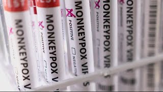 16 confirmed cases of Monkeypox in DC, health department releases some vaccine appointments