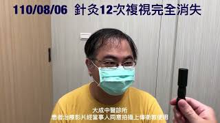 糖尿病複視，針灸12次恢復正常（雙眼複視）