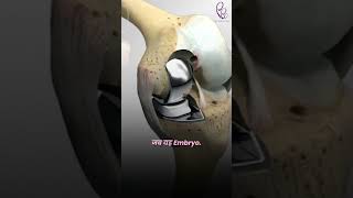Can You Freeze an Embryo for 5 Years? This Baby Proves You Can | IVF Success Story at Ayuh #pregnant