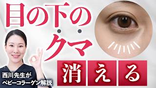 【目の下のクマが消える】ベビーコラーゲンを使ったクマ治療を紹介します。