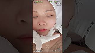 🤍無痛膠原逆齡槍🤍膠原滿滿！