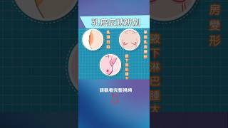 你有這些症狀嗎？注意這或是乳癌警訊！