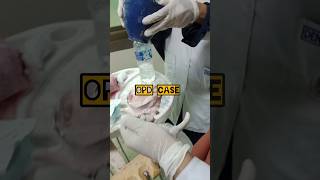 Opd cases 🤔 #shorts #drdaretodo #youtubeshorts #shortsfeed #shortsviral #viralshorts @drdaretodo