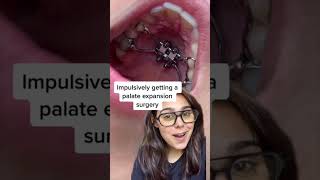 Orthodontist Reacts: Giant Tooth Gap From Expander And Jaw Surgery 😬 #shorts