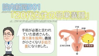 百合が丘クリニック朝刊「20代女性の卵巣嚢腫」
