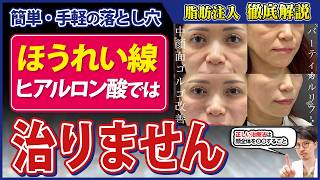 【真実を言います】ほうれい線を治すなら脂肪注入！ヒアルでは消せません。【ほうれい線治療ヒアルと脂肪注入どっちがいい？問題】