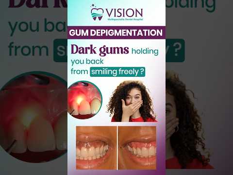 "Free Your Smile, Fade the Darkness"Are dark gums keeping you from smiling with confidence?