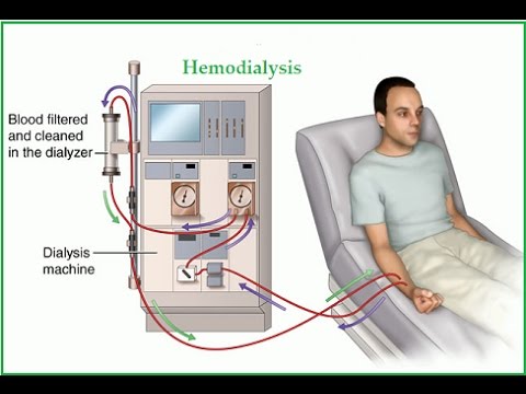 Dialysis video 2017