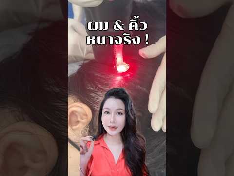 👩🏻ผมและคิ้วหนาขึ้นจริงเพราะเลเซอร์ใหม่ล่าสุดตัวนี้ !! ##erkerkbeauty #wwwerkerkcom #redtouchpro