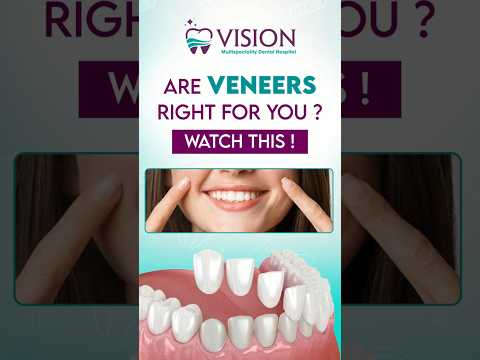 ✨ "Transform Your Smile with Veneers – The Secret to a Perfect Look!" 😁