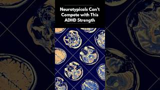 ADHD Strengths Neurotypicals Can't Match?  #ADHD #Neurodivergent #ADHDStrengths #Hyperfocus #Shorts