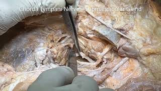 INFRATEMPORAL FOSSA PTERYGOID Muscle MAXILLARY Artery MANDIBULAR Chorda Tympani Nerve –Sanjoy Sanyal