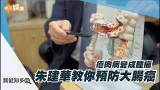 【醫健知多D】朱建華教你預防大腸癌