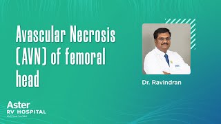 Dr. Ravindran | Avascular Necrosis | Orthopedics Specialist In Bangalore | Aster RV Hospital