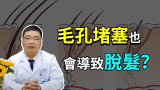 【毛髮知識】毛孔堵塞會導致脫髮嗎？看看植髮醫生怎麼說！雍禾植髮|姚堔醫師