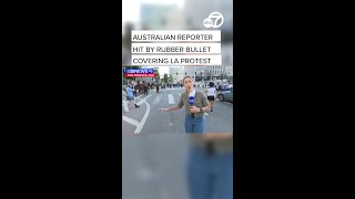 Reporter hit by rubber bullet while covering ICE protests in downtown LA