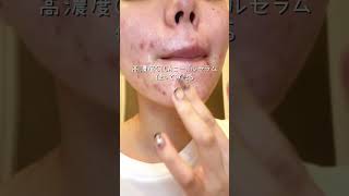 肌質改善はこれ一択#pr#スキンケア #カタン #美容液 #毛穴ケア