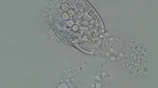 单细胞生物生命的最后时刻