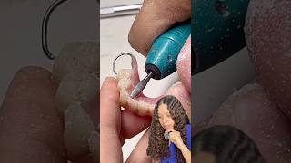 Pulido de una prótesis removible | #odontologia #protesisremovible #dentista