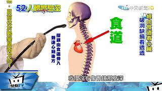 20170906中天新聞　人體實驗室　看透你的心　經食道心臟超音波
