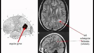 Cerebral Cortex (Big John)