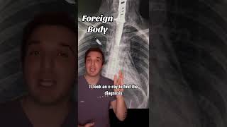Doc, i have a stabbing pain in my neck