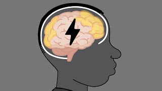HEADS UP to Sports Officials: Concussion Basics