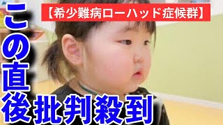 【希少難病ローハッド症候群・体験談】2歳ごろ急に太り始めたことが病気のサインだった…、40度の高熱から突然の意識不明に
