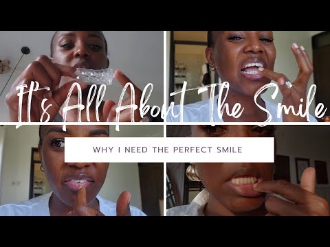 FINALLY FINDING CONFIDENCE IN MY SMILE| TRAY 1 - 4 UPDATE with URIEL DENTAL