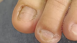 Pedicure July 24 #satisfying