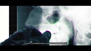 AeroXcan - Medivis