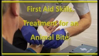 First Aid treatment for animal bites.