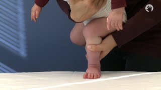 Clubfoot Stretches | Standing Out of the Braces | Module 3