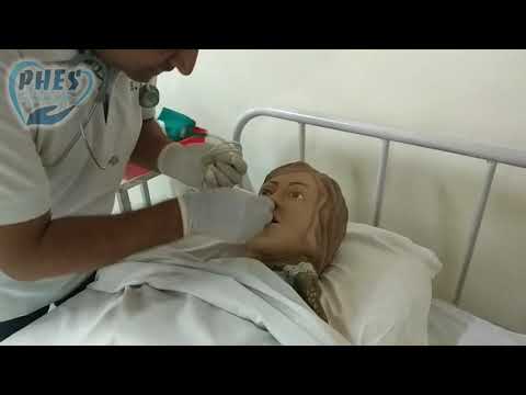 NasoGastric Tube Insertion- बातचीत विद डॉ अरुण जिंदल