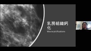 【乳癌】癌症教育系列講座