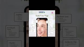 #acneawareness #AcneTreatment  |  #ClearSkin#AcneCare  |  #SkinCareRoutine#AcneFree  |  #pimplecare
