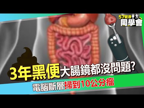 60歲翁「3年黑便」胃鏡、大腸鏡都沒問題？！電腦斷層「掃到10公分瘤」切這器官保命【 @57healthy  】#陳榮堅 醫師