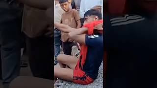 Animal Bites #rabies #shorts #trending #animalbites #dogbite #viral